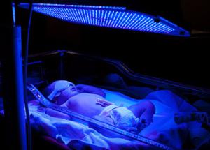 В больнице Зеи появились аппараты для лечения желтухи у новорожденных