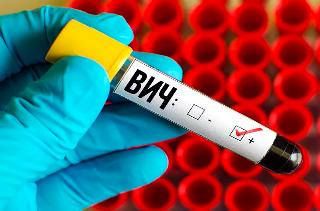 В Белогорске ВИЧ-инфекция подтверждена у 63 человек