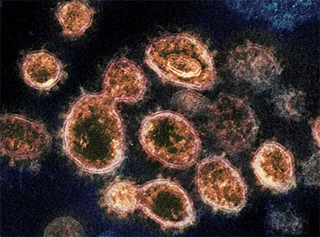 Роспотребнадзор создал высокоточный тест для диагностики коронавируса